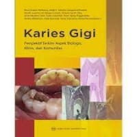 Image of Karies Gigi : Perspektif Terkini Aspek Biologis, Klinis Dan Komunitas