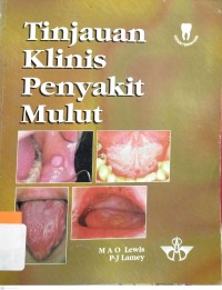 Image of Tinjauan Klinis Penyakit Mulut