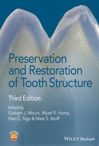 Image of Preservation And Restoration Of Tooth Structure