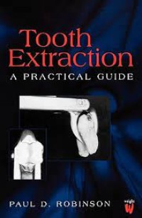 Image of Tooth Extraction : A Practical Guide