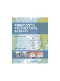 Periodontal Regenerative Therapy