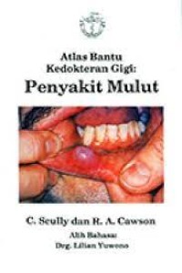 Atlas bantu kedokteran gigi : Penyakit Mulut ( Colour Aids In Dentistry : Oral Medicine)
