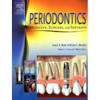 Image of Periodontics Medicine, Surgery And Implans
