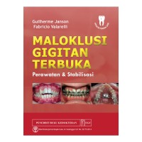 Image of Maloklusi gigitan terbuka : Perawatan & stabilisasi