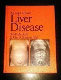 Image of A Colour Atlas Of liver Disease