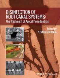 Image of Disinfection Of Root Canal System : The Treatment Of Apical Periodontitis
