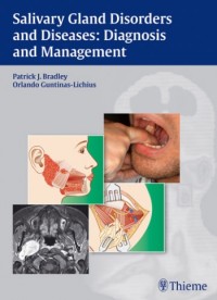 Image of Salivary gland disorders and diseases : Diagnosis and Management