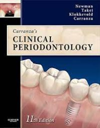 Image of Carranza's Clinical Periodontology (e-Book)