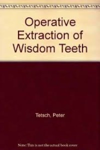 Image of Operative Extraction Of Wisdom Teeth