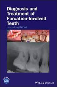 Diagnosis And Treatment Of Furcation-Involved Teeth (e-Book)