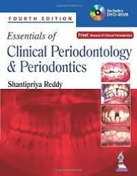Essentials Of Clinical Periodontology & Periodontics