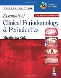 Image of Essentials Of Clinical Periodontology & Periodontics