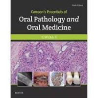 Image of Cawson's Essential Of Oral Pathology And Oral Medicine