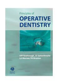 Principles Of Operative Dentistry