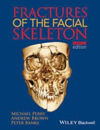Fractures Of The Facial Skeleton (e-Book FKG)