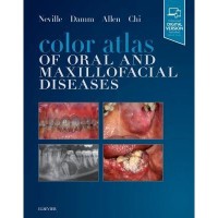 Color Atlas Of Oral And Maxillofacial Diseases