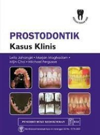 Prostodontik Kasus Klinik