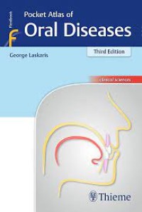 Pocket Atlas Of Oral Diseases (E-Book)