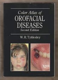 A Colour Atlas Of Oro-Facial Diseases
