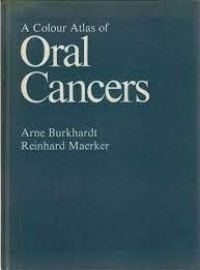 A Colour Atlas Of Oral Cancers
