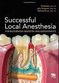 Successful Local Anesthesia : For Restorative Dentistry And Endodontics
