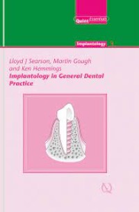 Implantology In General Dental Practice