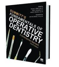 Summit's Fundamentals Of Operative Dentistry : A Contemporary Approach