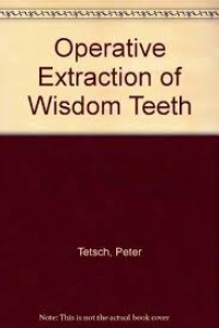 Operative Extraction Of Wisdom Teeth